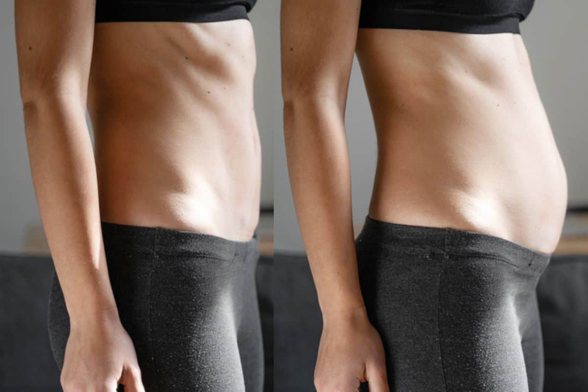 How long does diastasis recti take to improve Feltham?