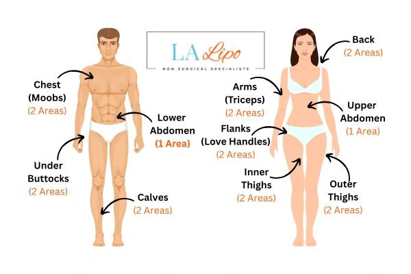 LA LIPO Cryolipolysis Areas Feltham