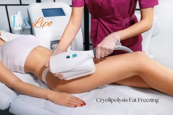 Woman receiving coolsculpting Feltham treatment on her thighs