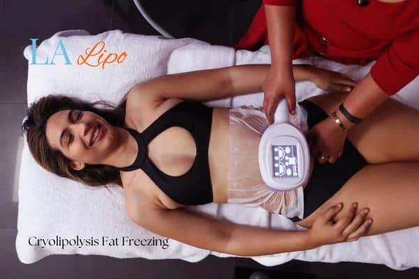 woman getting cryolipolysis Feltham