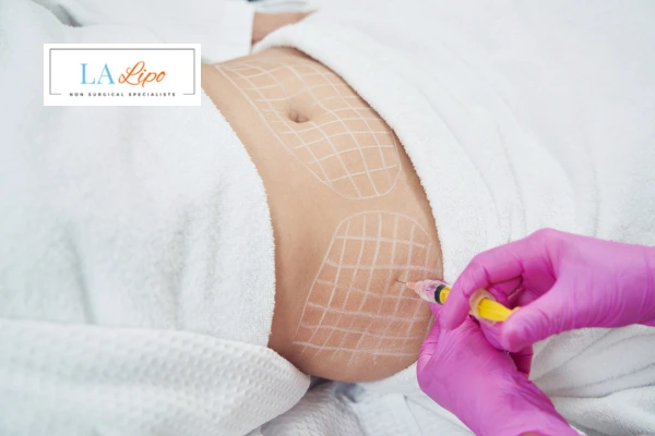aqualyx fat dissolving injections Feltham