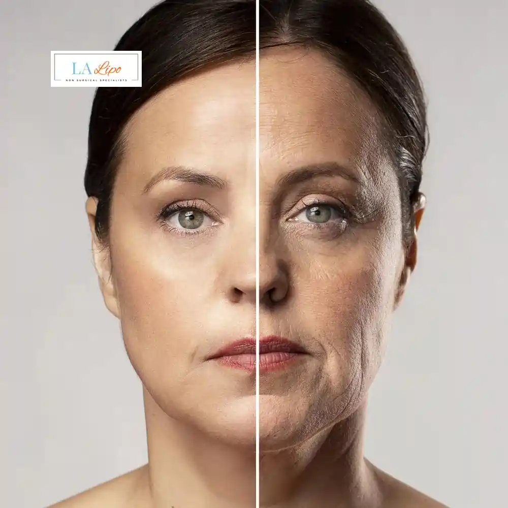 How Can You Tell If Non-Surgical Skin Tightening Is Right for You Feltham?