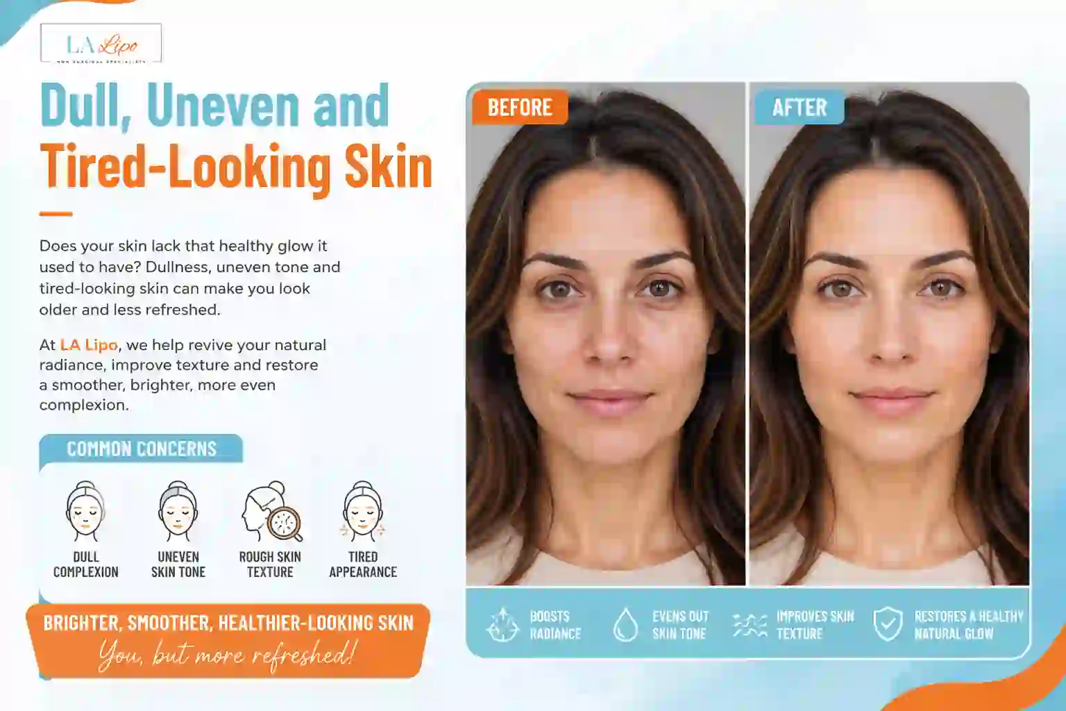 Sign #5: Dull, Uneven and Tired-Looking Skin Feltham