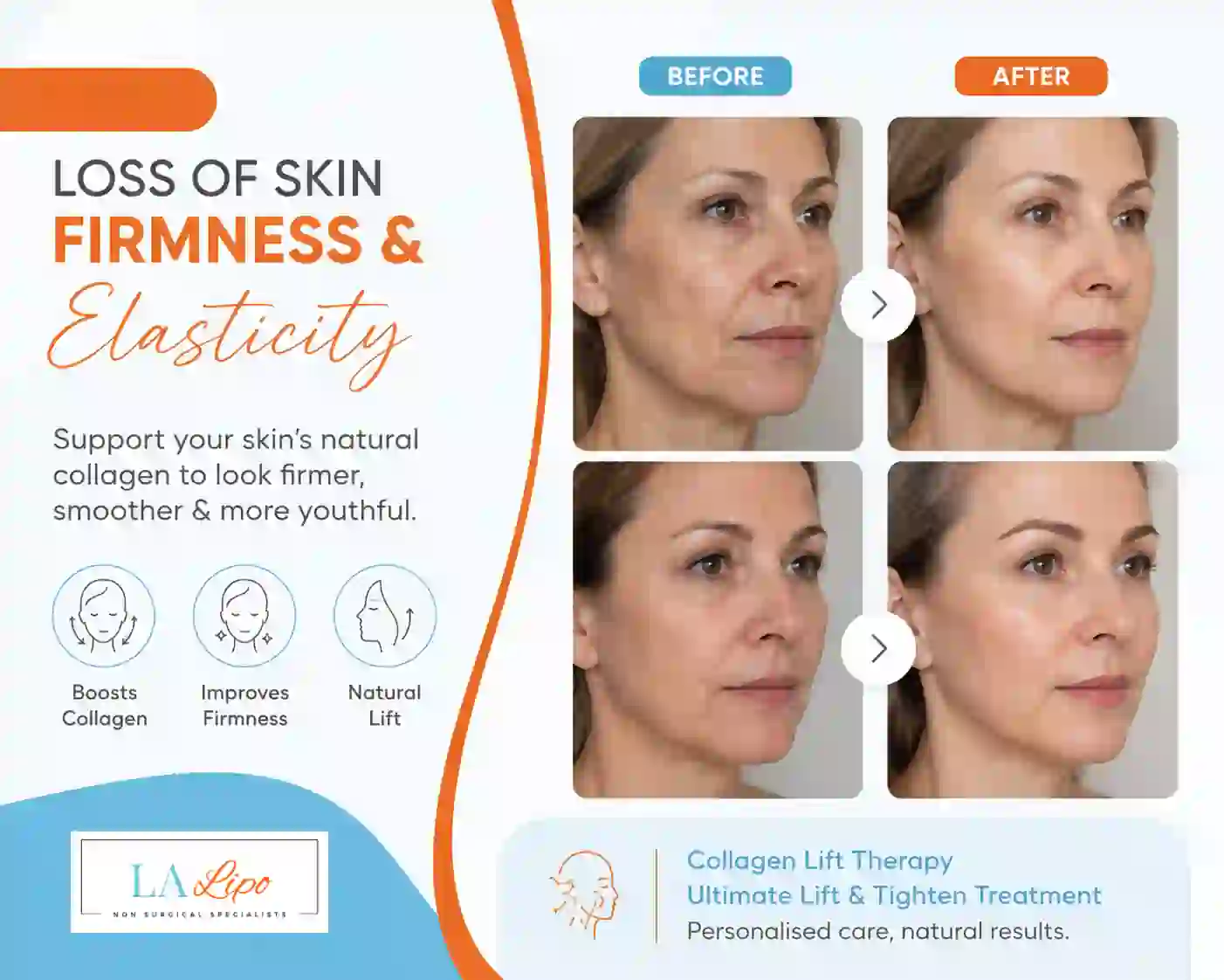 Sign #7: Loss of Skin Firmness and Elasticity Feltham